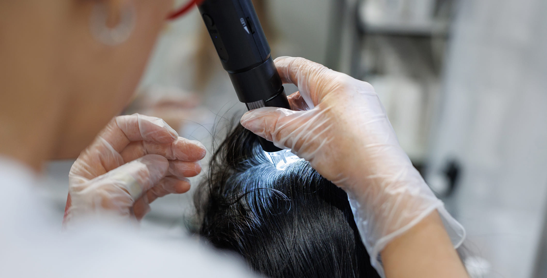 Médicaments perte de cheveux Montréal