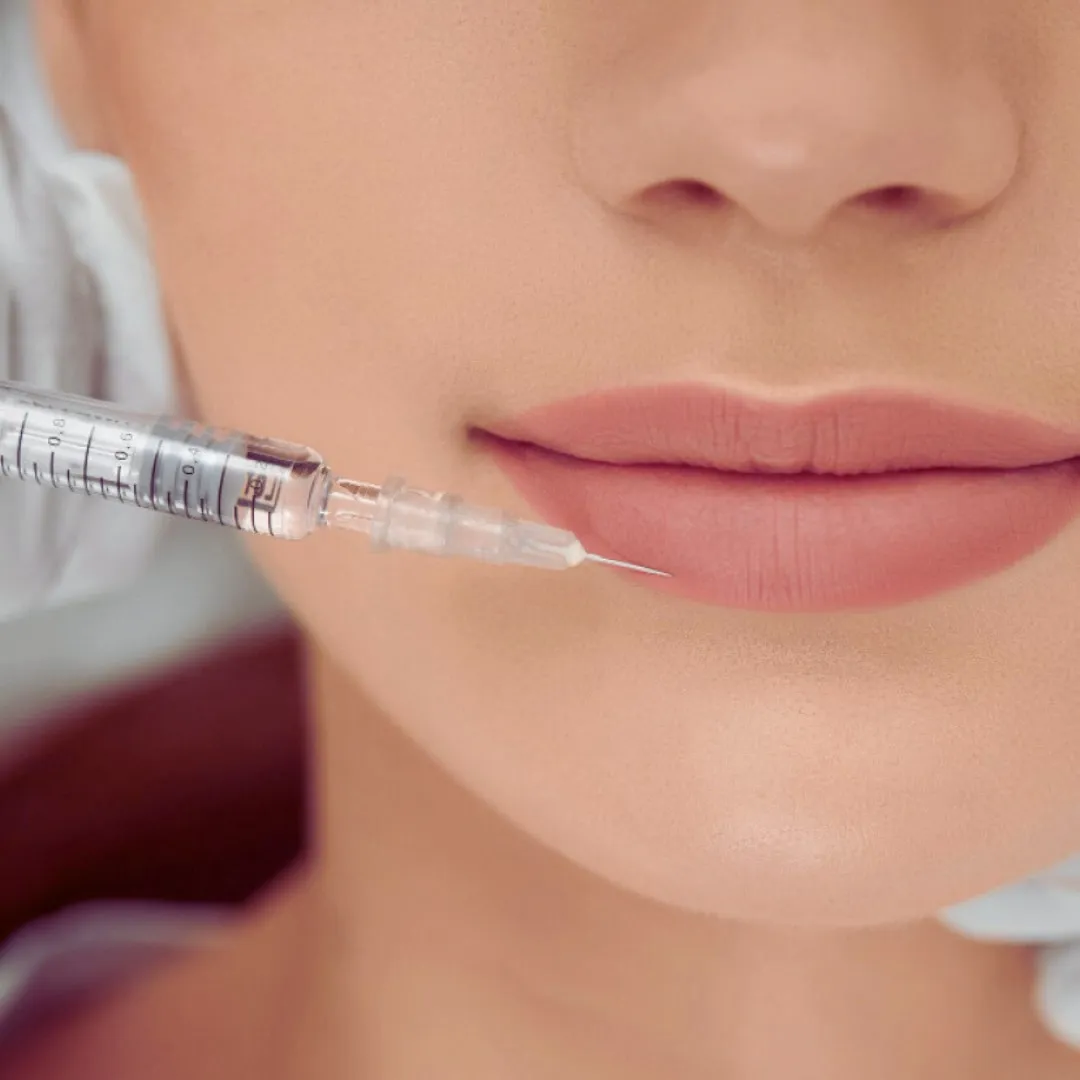 Sculptra®-a-Montreal