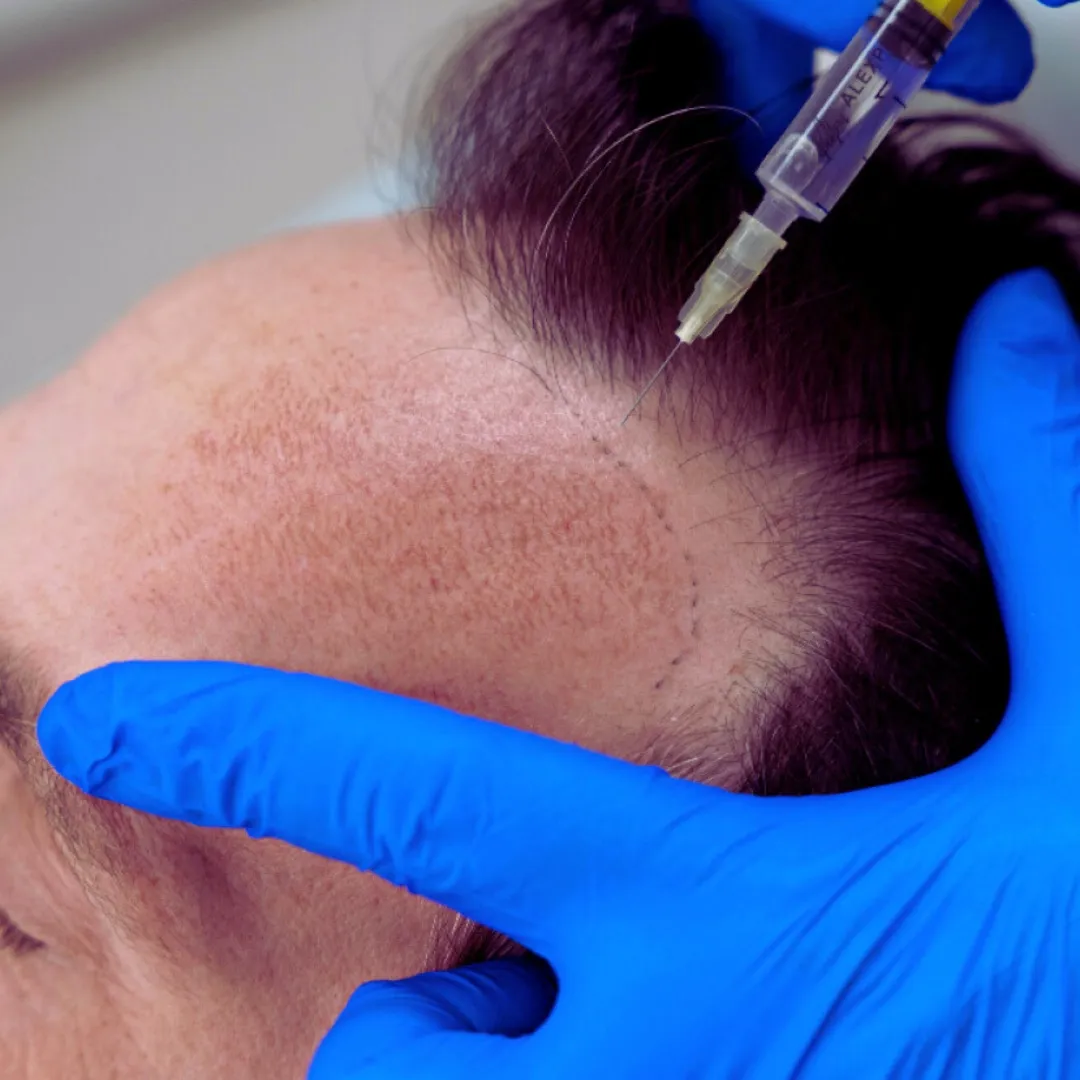 Therapies-regeneratives-a-Montreal